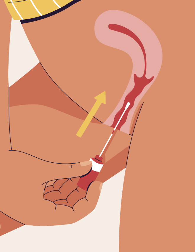 graphic of a self-collected cervical screening test showing that the swab must be moved in a circular motion for 20-30 seconds