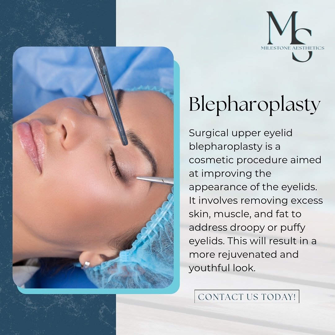 Did you know we offer Blepharoplasty at our medical spa? This cosmetic procedure provides a rejuvenated youthful look 🤍
Interested in learning more about this service? Reach out today!! ✨

#blepharoplastysurgery #blepharoplastyuppereyelid #blepharop