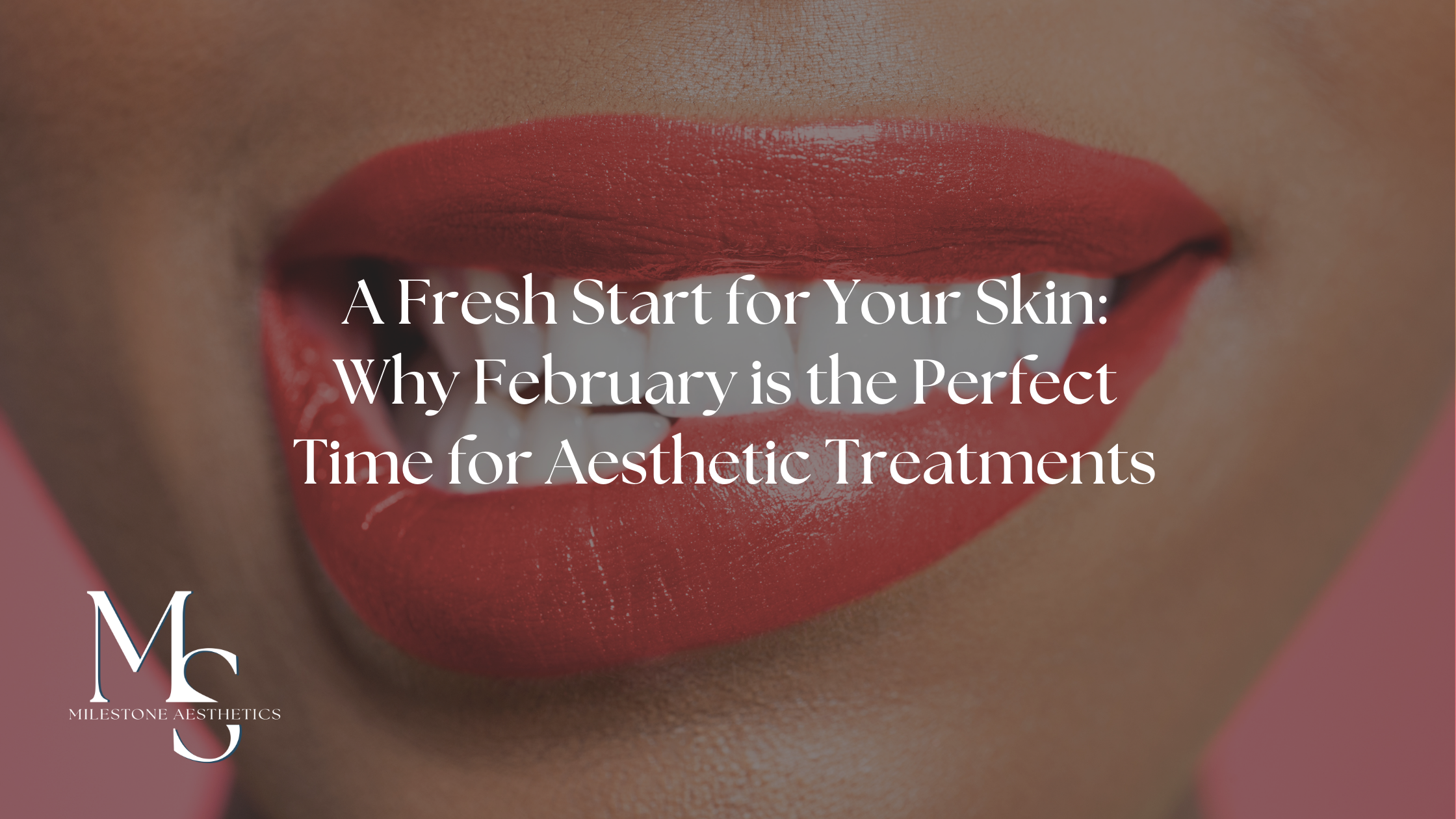 A Fresh Start for Your Skin: Why February is the Perfect Time for Aesthetic Treatments
