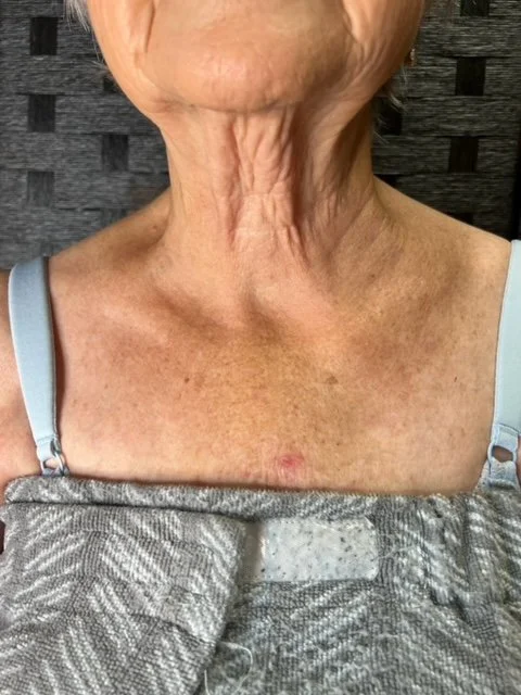 Close-up of an elderly woman's neck with visible wrinkles and age spots, wearing a blue sleeveless top.