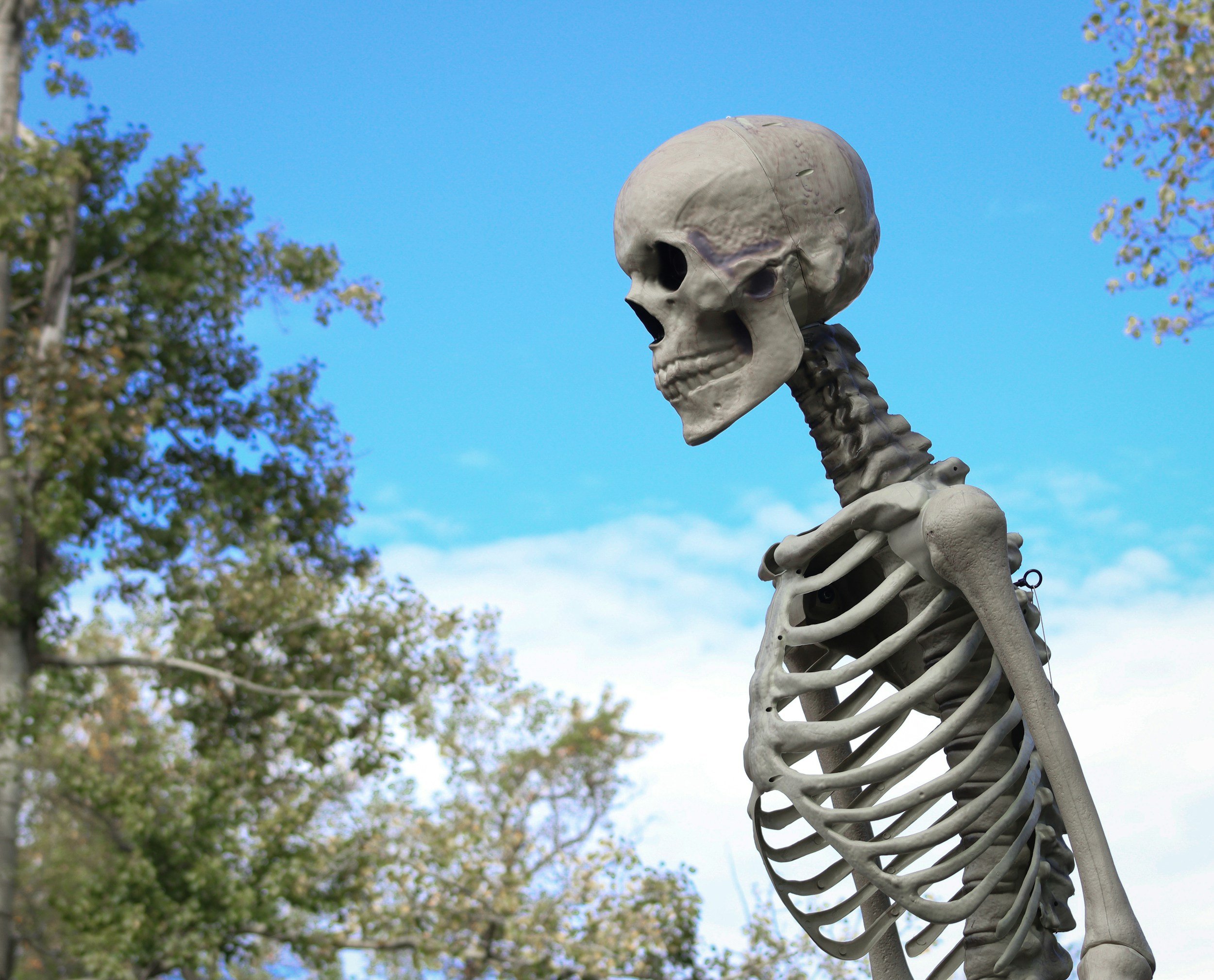 Osteopenia vs Osteoporosis:                            What Physiotherapy Does Differently