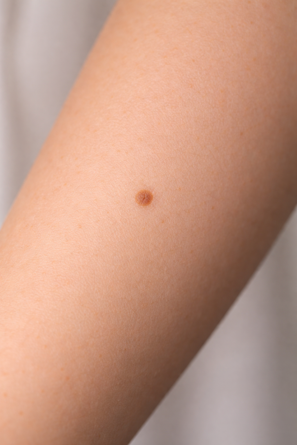 “Should I Be Worried If My Moles Haven’t Changed Since My Last Skin Check?”
