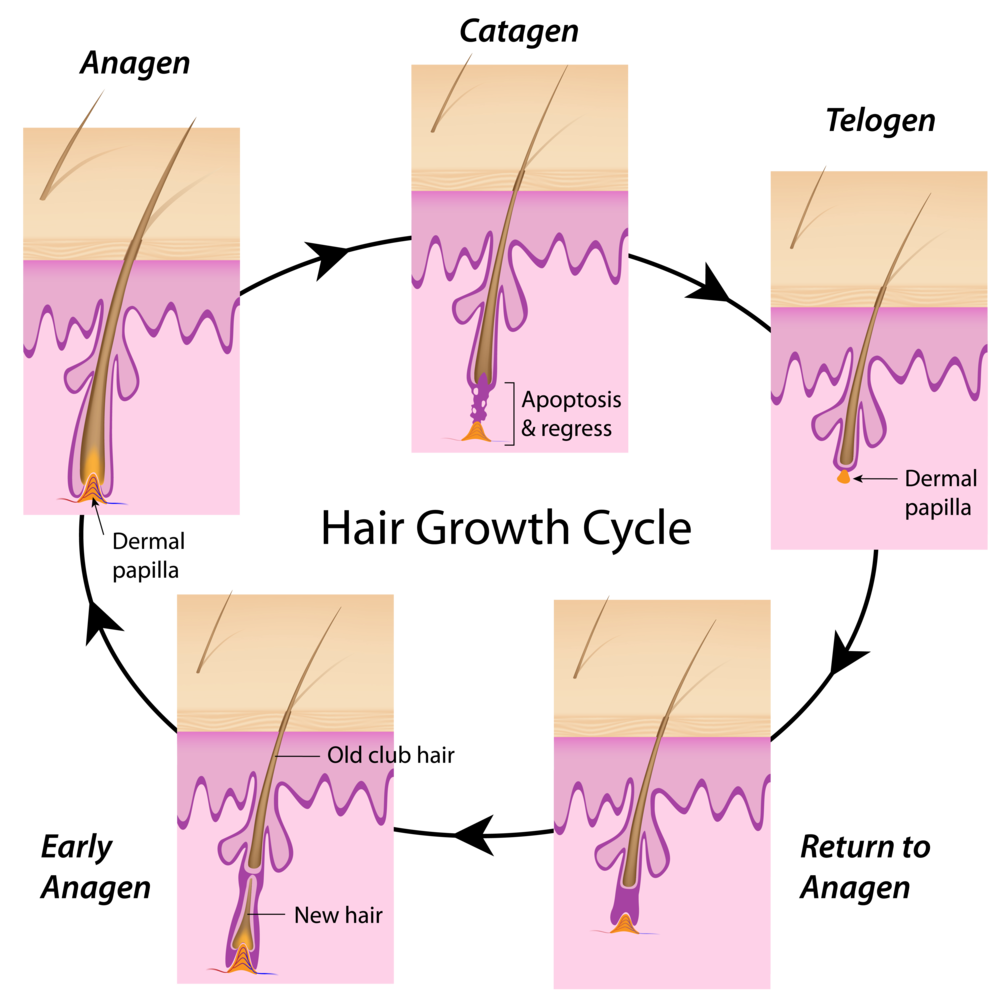 The Salon Hair and Scalp Clinic - DHT affect sensitive hair follicle two  ways : First, it shortens the hair growth cycle, which “ages” the hair  follicle, second, it causes miniaturization of