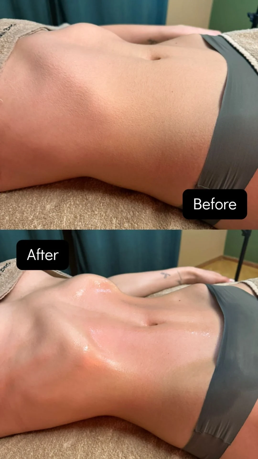 Prima Dopo Linfo Scultura