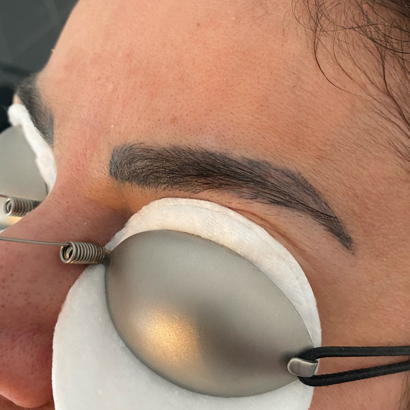 Tatueringsborttagning med PicoPlus hos NUDE! 💥

Svep f&ouml;r att se det f&auml;rdiga resultatet! - Ruwaida har totalt f&aring;tt 5 behandlingar av sina PMU-&ouml;gonbryn. Vi har gett 6-8 veckor mellan varje behandling f&ouml;r att uppn&aring; resul