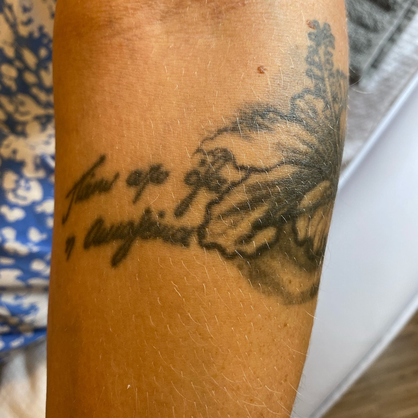 Tatueringsborttagning med PicoPlus hos NUDE! 💥

F&auml;rdig! Alexandra har genomg&aring;tt totalt 8 behandlingar f&ouml;r sin tatuering p&aring; armen. Ig&aring;r gav vi henne den sista behandlingen f&ouml;r att uppn&aring; det slutliga resultatet, 