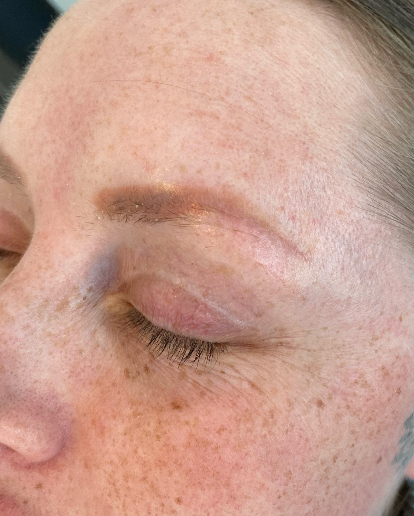 Tatueringsborttagning med PicoPlus hos NUDE! 💥

F&auml;rdigt! - Pauline avslutade ig&aring;r sin behandling av PMU-&ouml;gonbrynen. M&aring;let var att helt ta bort de gamla brynen s&aring; att hon kunde f&aring; tillbaka sitt naturliga utseende och