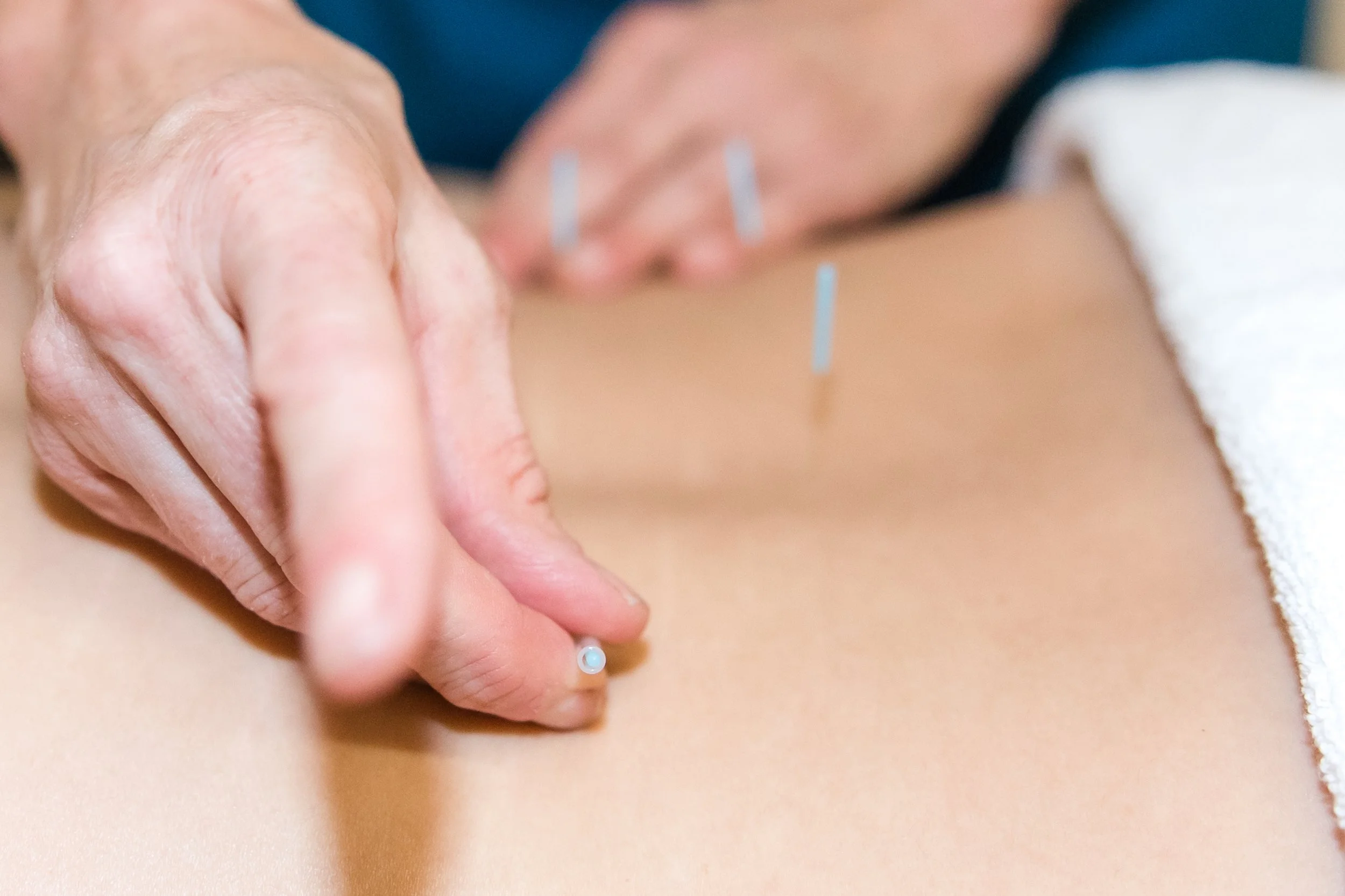 acupuncture-practitioner-doctor.jpg