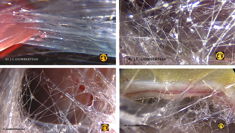 What is Fascia?