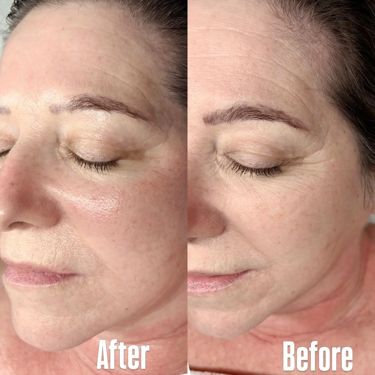 These results 😍✨

I did a facial sculpting session with buccal massage and I&rsquo;m honestly obsessed with how much this can lift, de-puff and bring the face back to life naturally.😉

Also sorry I&rsquo;ve been a little quiet on here lately, life 