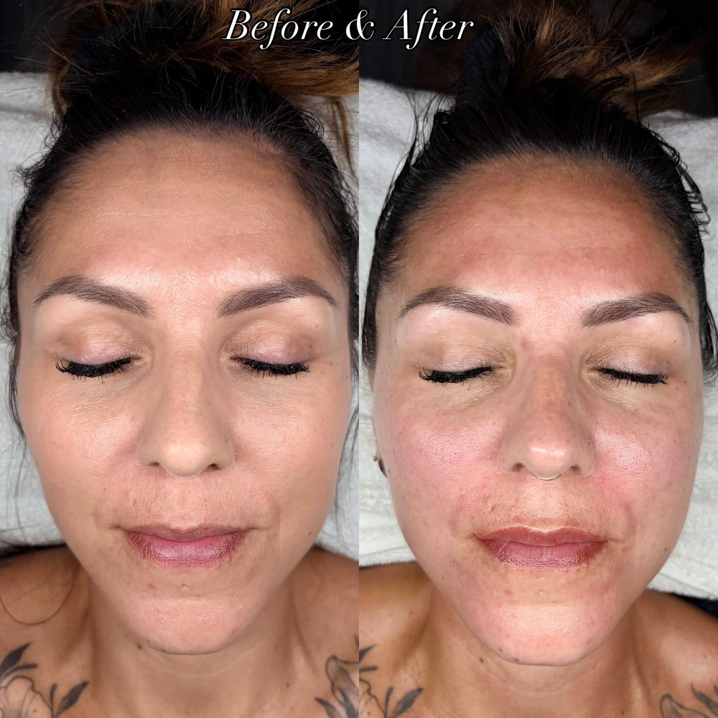 More than just a facial 😍

These before &amp; after photos were taken after just ONE Buccal Massage Facial!! 

Notice the reduction in puffiness, improved facial contour, softer tension through the jaw and cheeks and an overall brighter, more refres