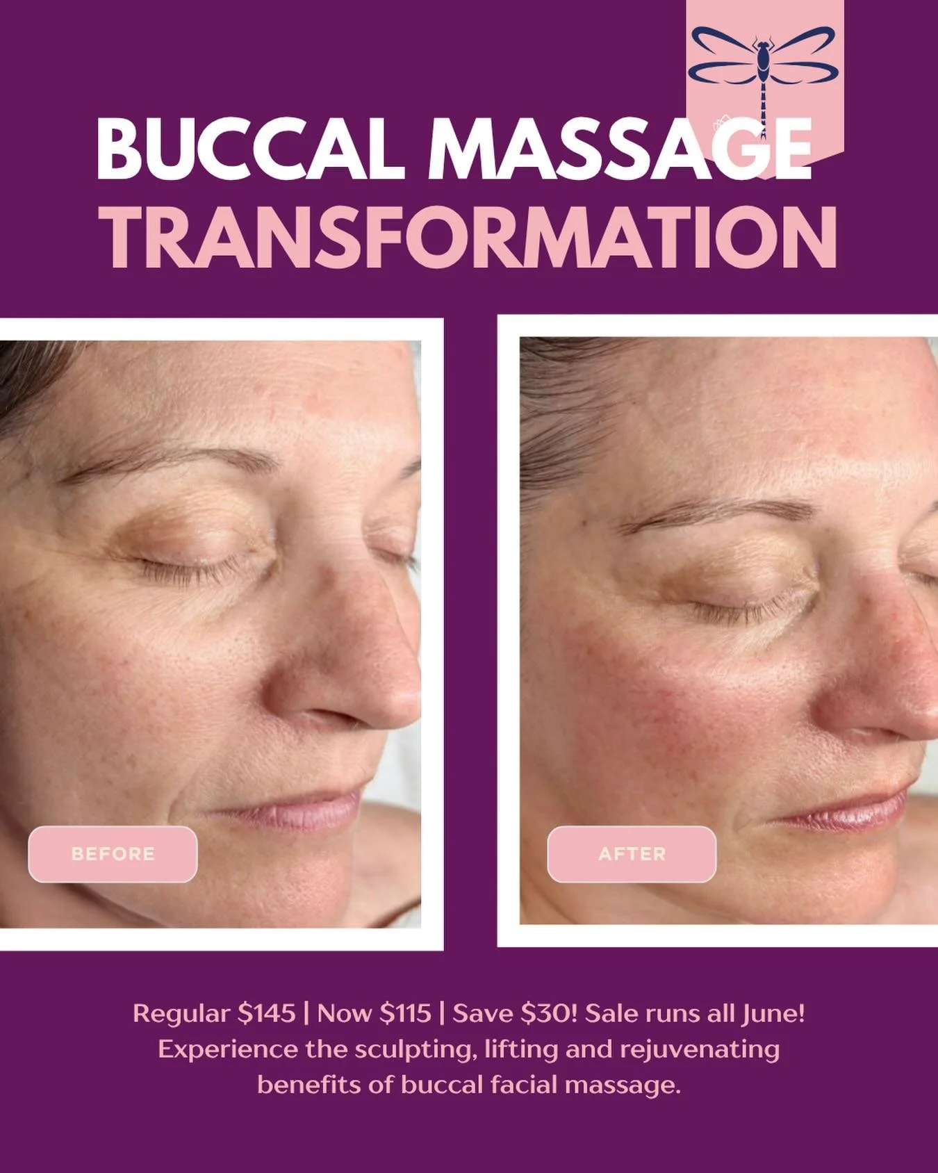 JUNE SPECIAL 🦋

Look closely at the difference after just ONE Buccal Massage session.🤩

Notice the lifted cheeks, more defined jawline, softened tension around the mouth, improved circulation and overall brighter, more youthful appearance. These re