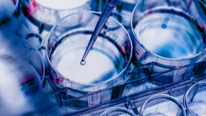 Understanding the Importance of Sample Collection in Medical Research ...