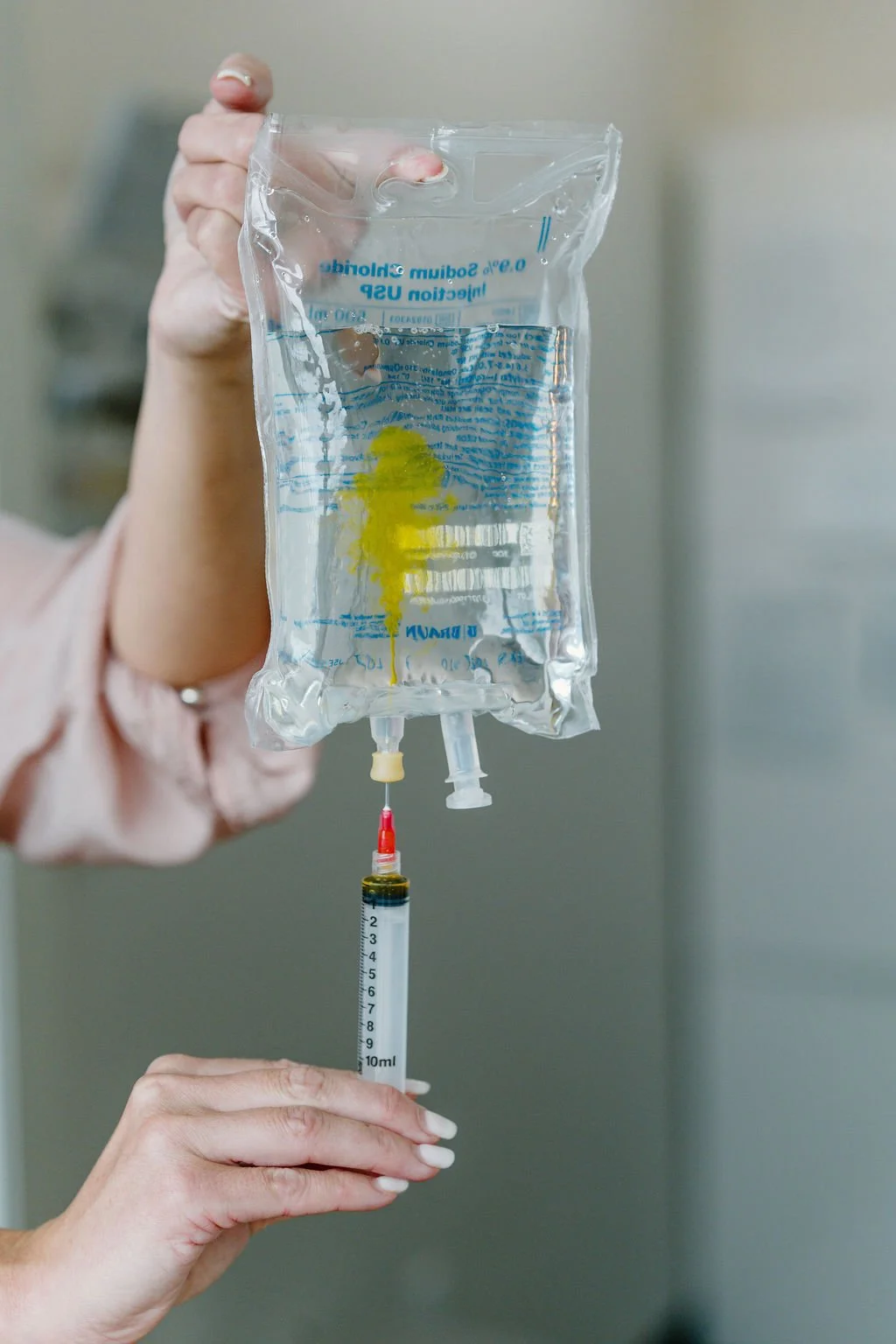 A person holding a clear IV bag filled with a yellowish liquid, with an attached syringe beneath it, in a medical setting.