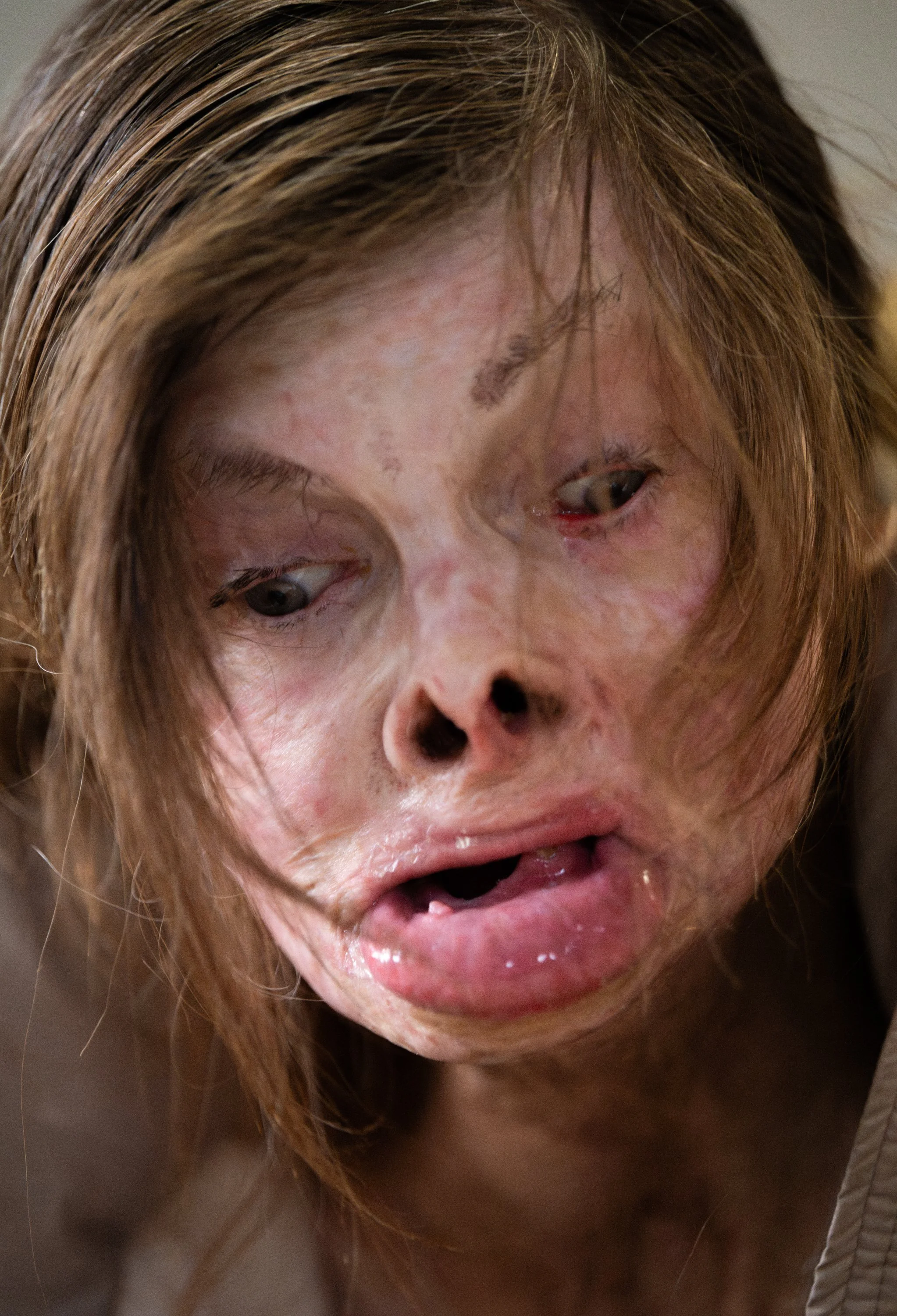 Robin Carpenter meets with Stephen Rosa to fill out PCHO paperwork at St. Peter's Kitchen on April 17, 2026. The resulting burns left Carpenter legally blind and with very little feeling and mobility in her body.