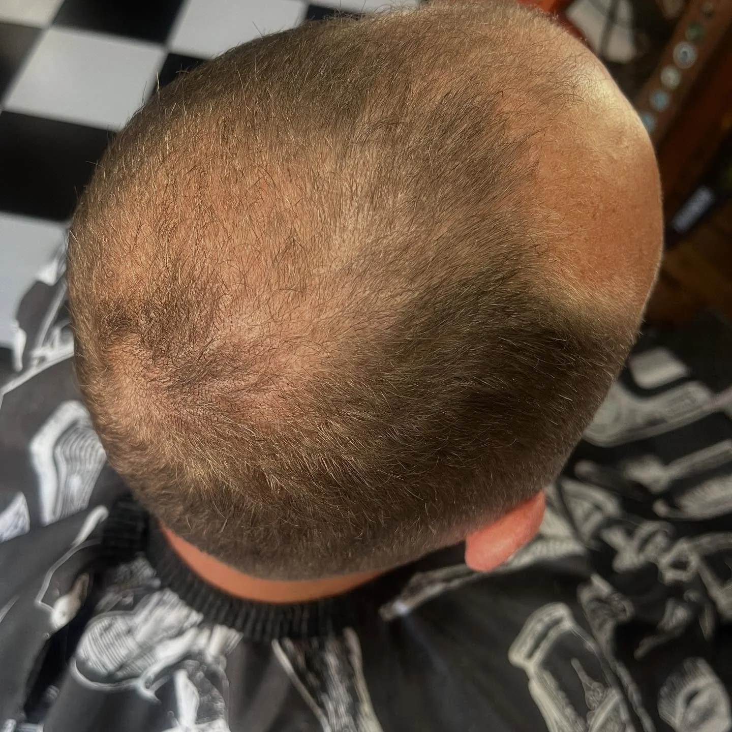 Before/after
Nishman Keratin Fibre💈😅