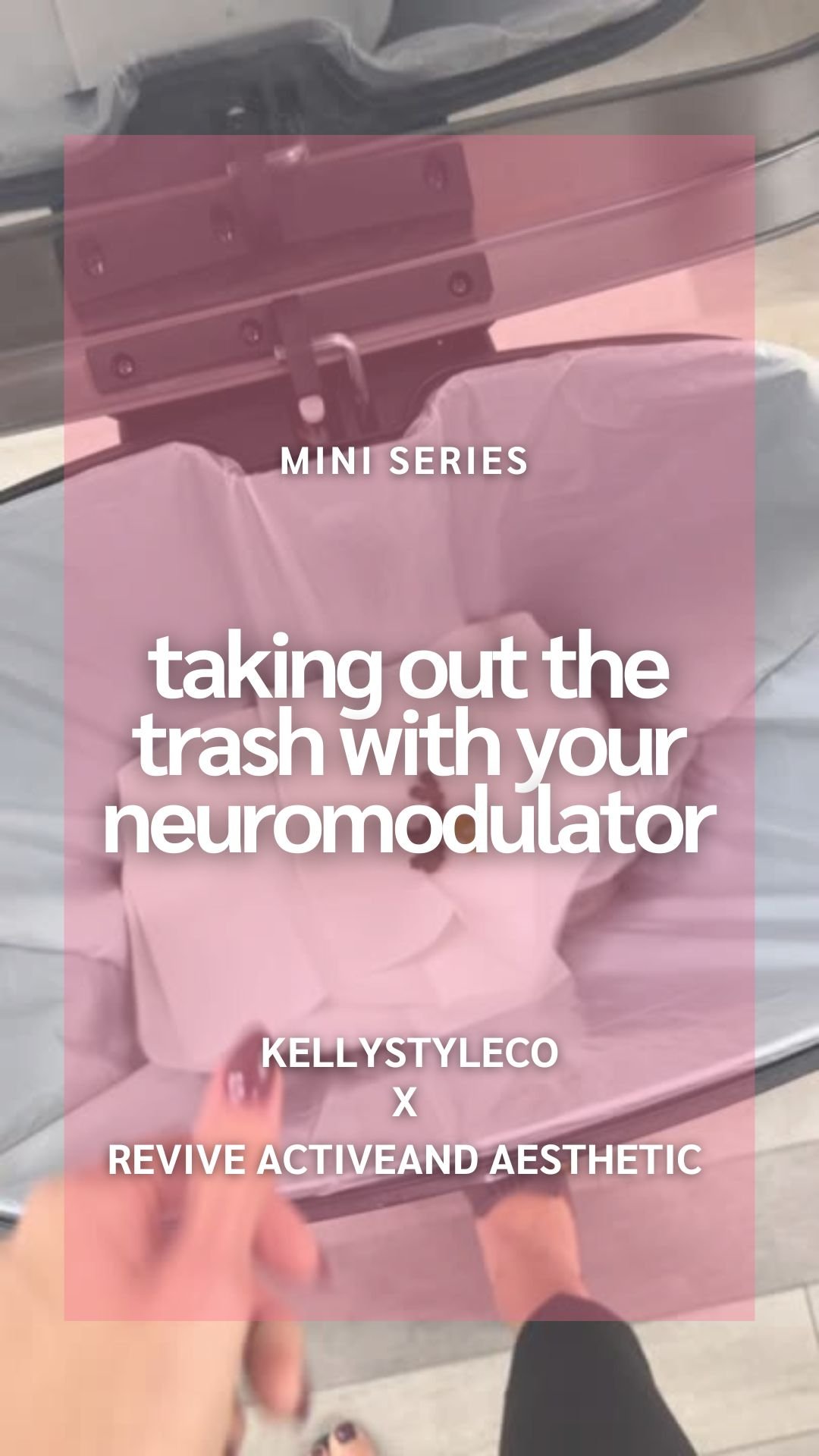 Taking Out the Trash with Xeomin: My SmartTox Experience