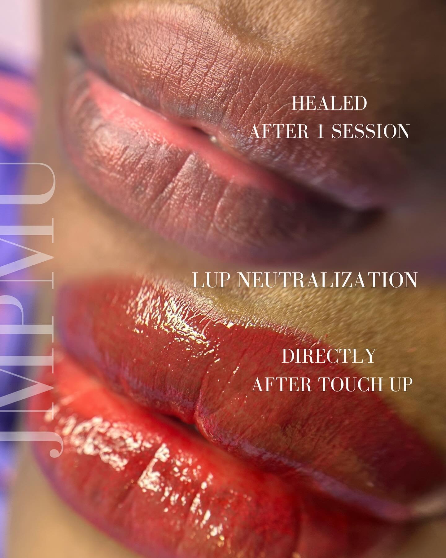 Lip neutralization, evening out 2 time colours .