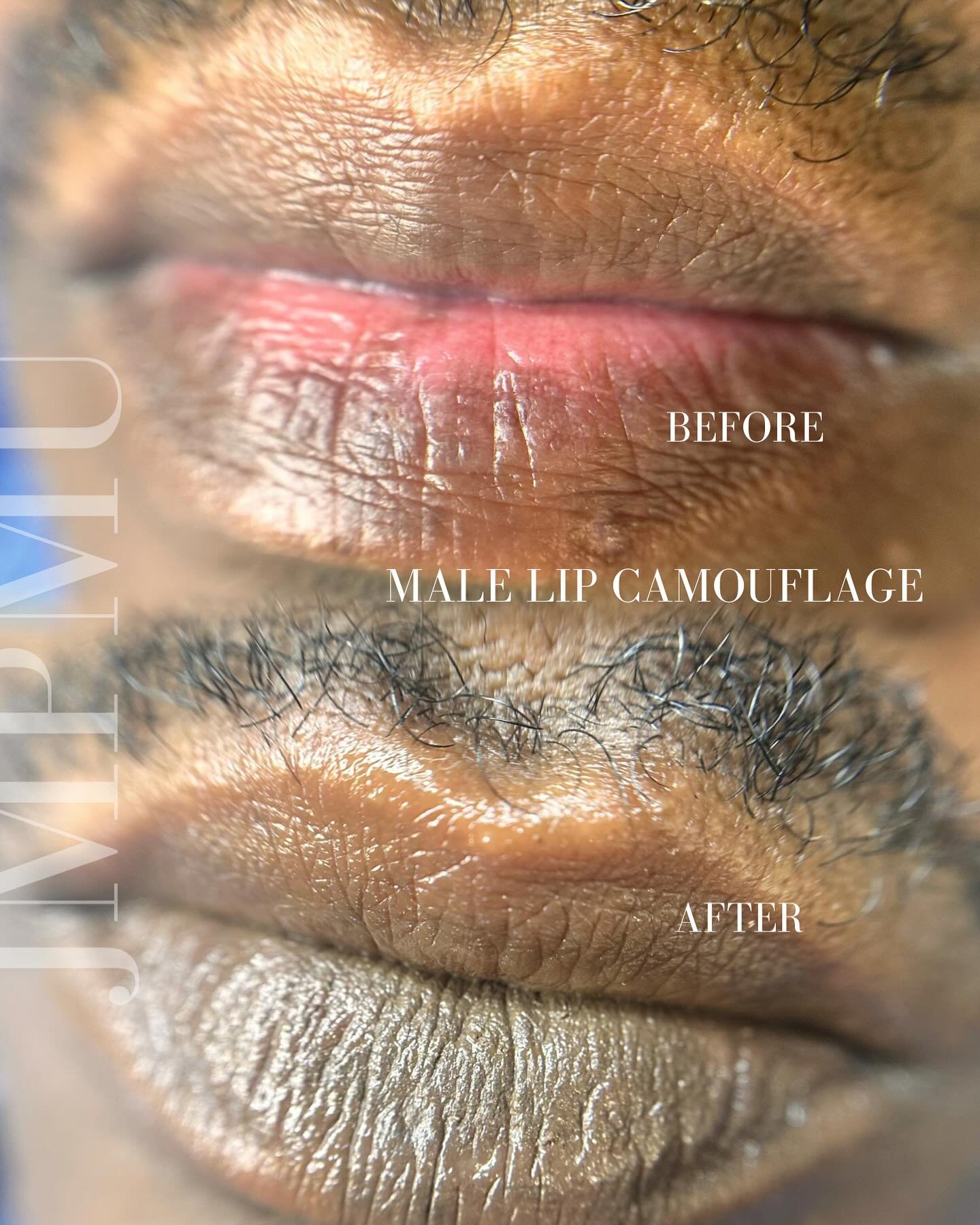Male lip camouflage