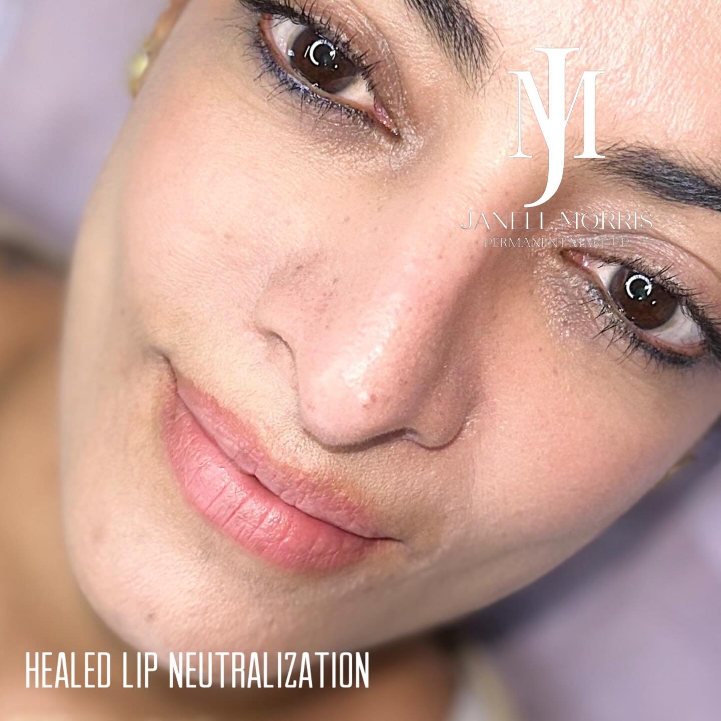 HEALED THE light lip neutralization. 💋