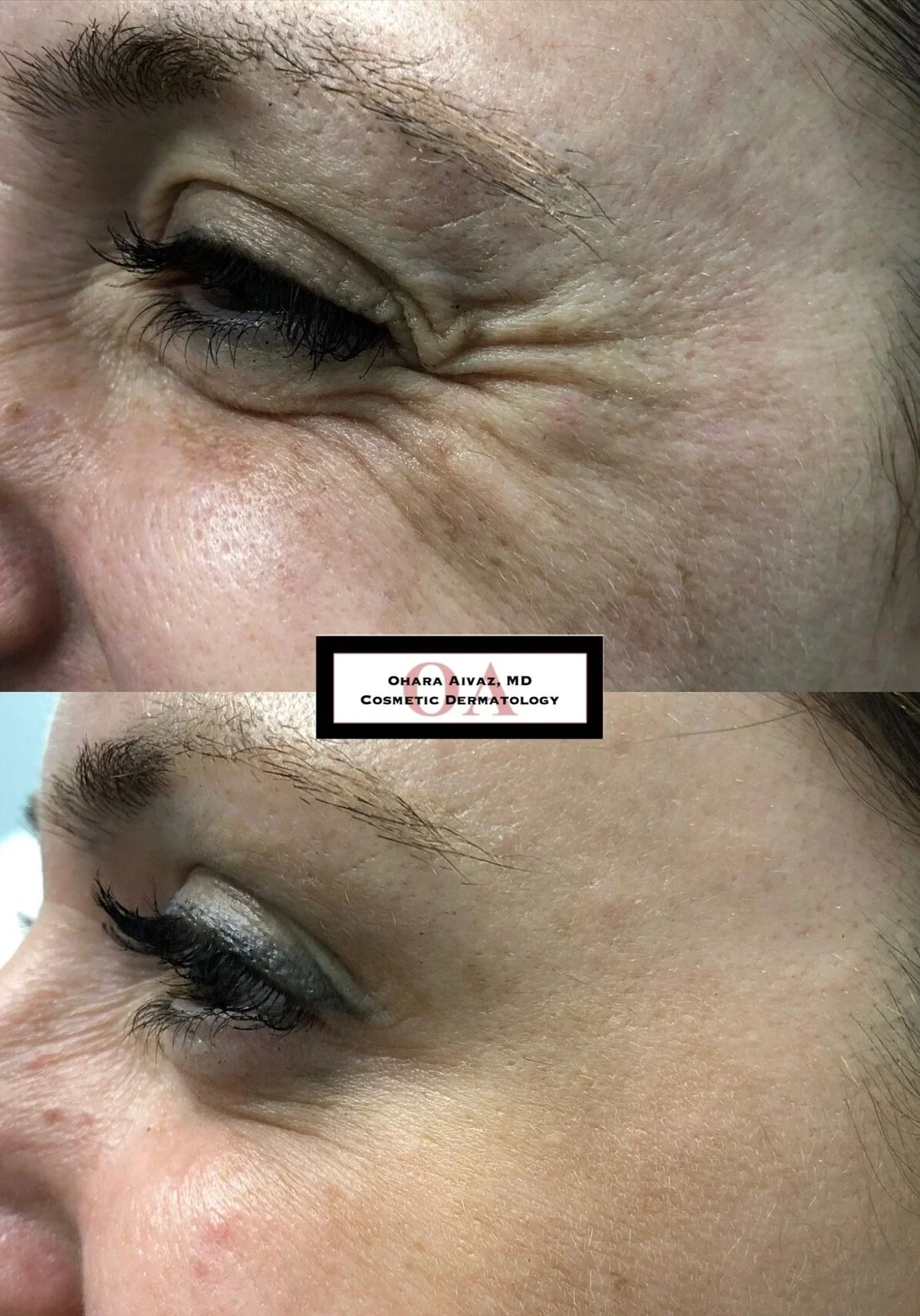 Before (Top) I After (Bottom)