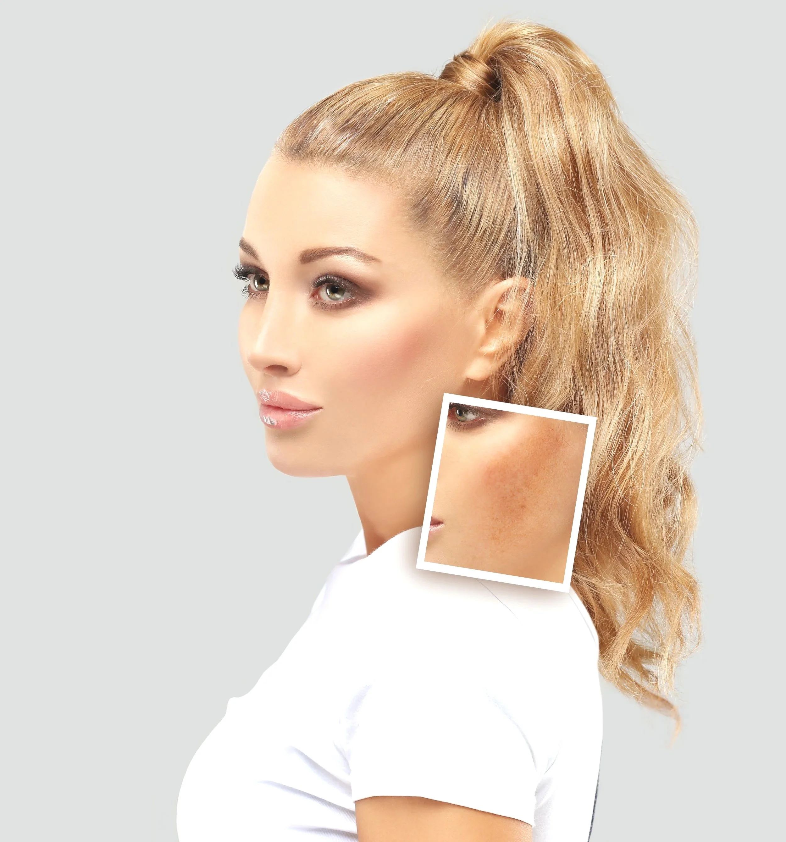 Side profile of a woman with long, wavy blonde hair tied in a high ponytail, with a close-up inset showing freckled skin.