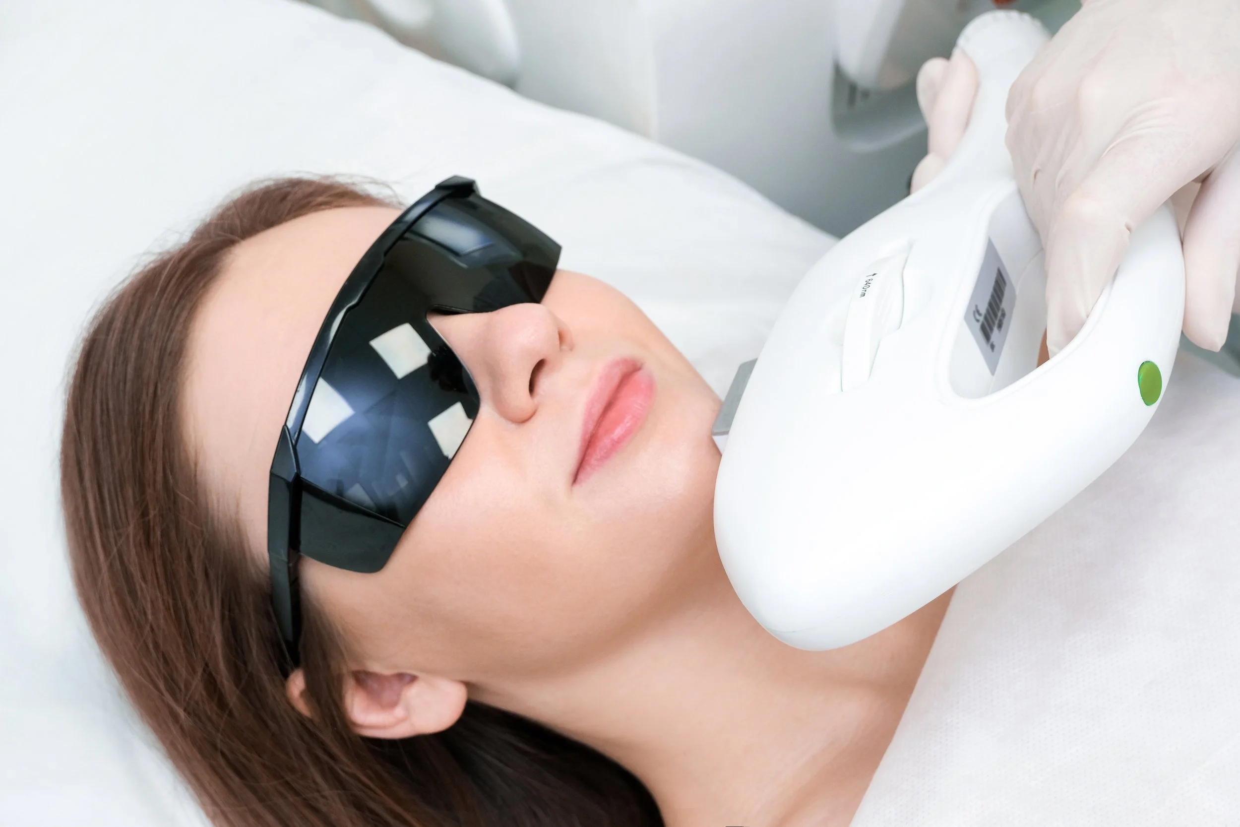 A woman with brown hair wearing protective eyewear undergoing a laser treatment or skin procedure with a handheld device operated by a medical professional.