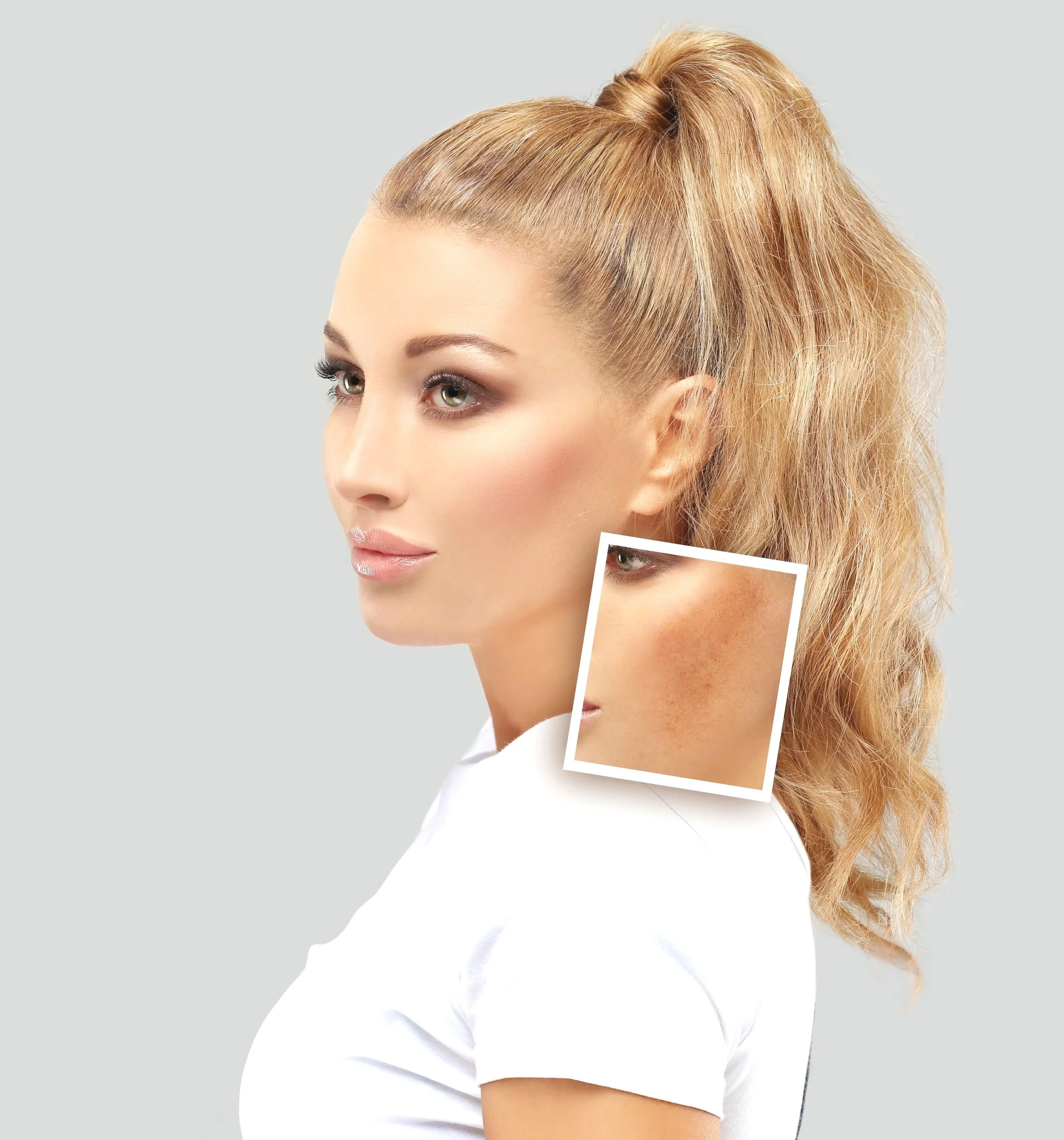 Close-up of a woman with blonde, curly hair in a ponytail, with a zoomed-in inset showing her freckled skin.
