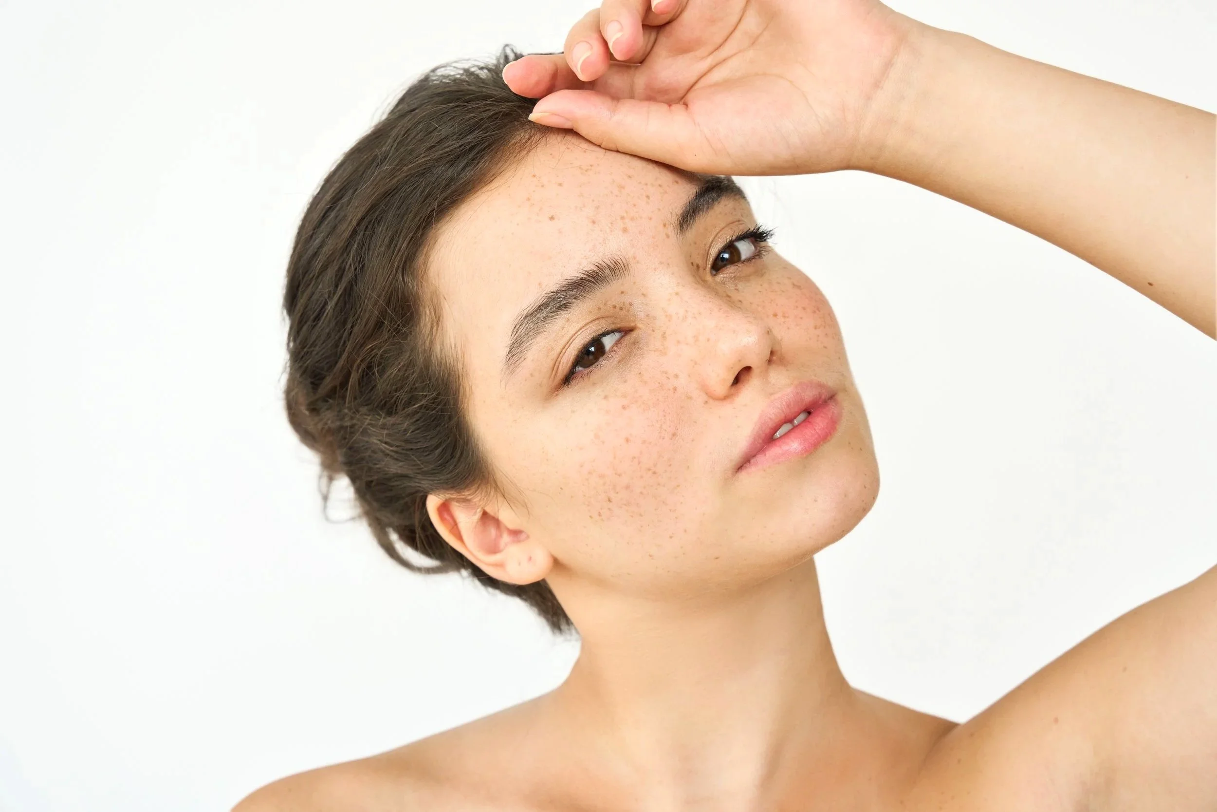 Close-up of a young woman with fair skin, freckles, and short brown hair, posing with her hand on her forehead against a white background.
