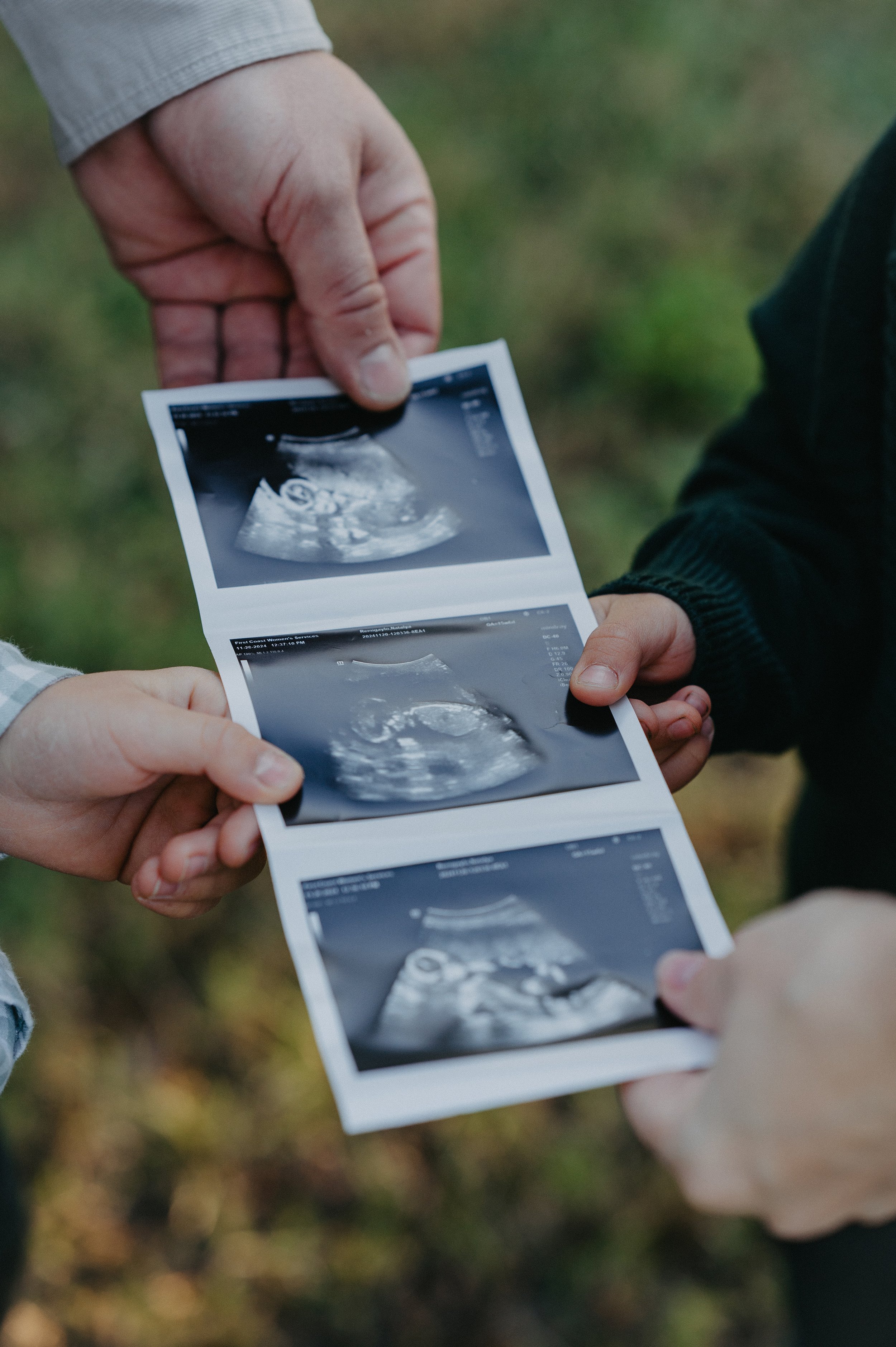 Three people holding ultrasound images of a developing fetus outdoors.