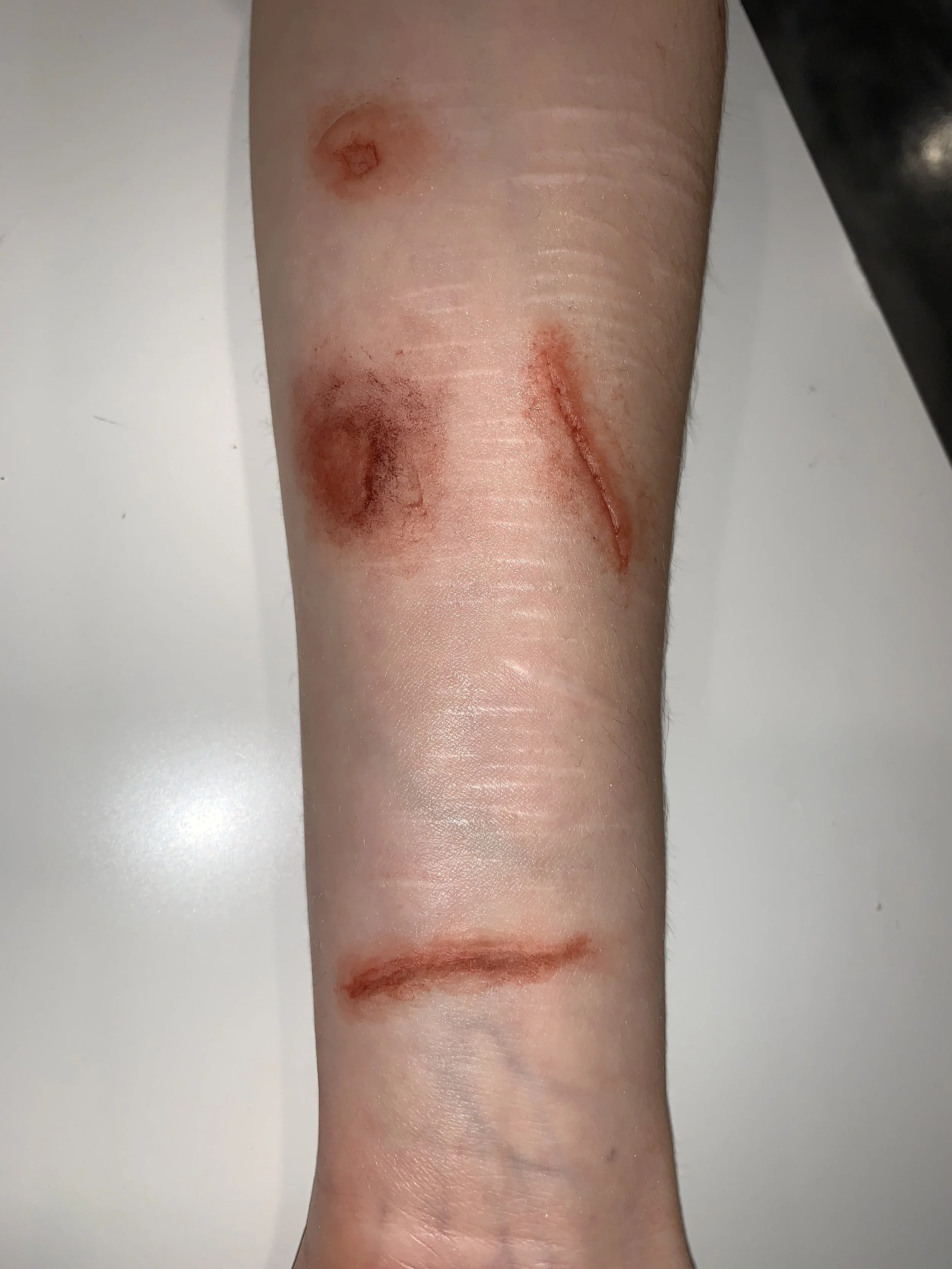 Wounds.jpg