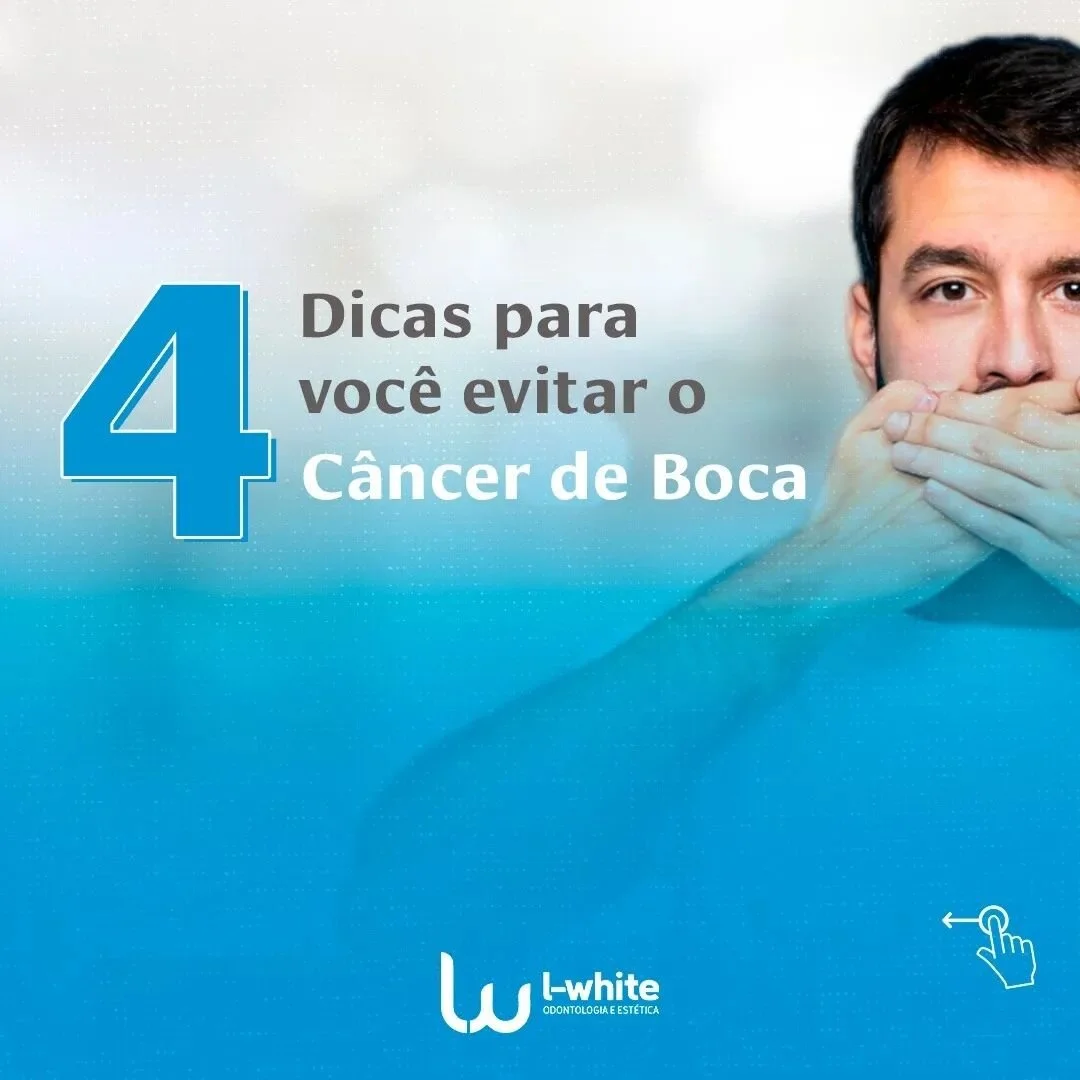 O câncer de boca 👄 pode ser desencadeado por inúmeros motivos... mas, muitos deles estão associados aos hábitos de vida classificados como inadequados!
Entretanto, existem algumas medidas que você pode adotar para e