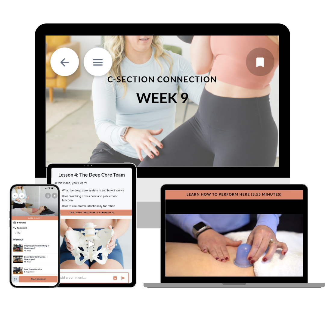 physical therapist cupping a c-section scar