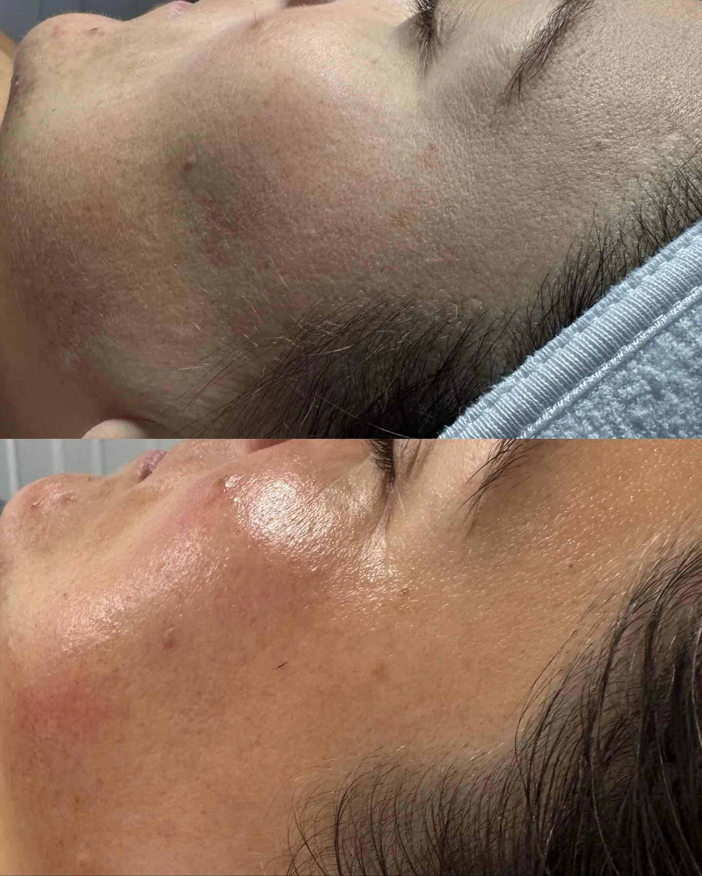 Get the JFB Glow ✨🤍

We use @mariniskinsolutions skincare. Formulated with top-quality, clinically tested medical-grade ingredients for a healthy, radiant, glowing complexion.

Your results begin when you take that first step.

all appointments can 