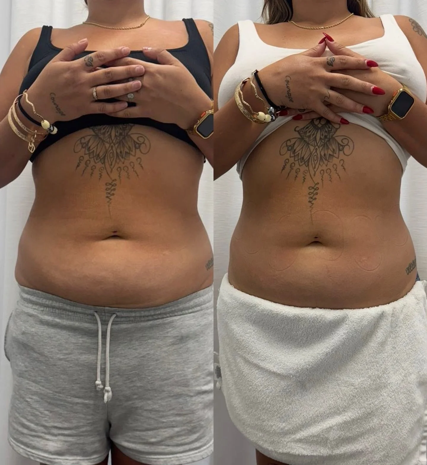 FACE OR BODY WE GOT YOU 🔥

Non-invasive body sculpting treatments are highly effective when paired with consistency + healthy lifestyle habits. Regular sessions, hydration, and mindful nutrition all help maximize and maintain your results. It&rsquo;