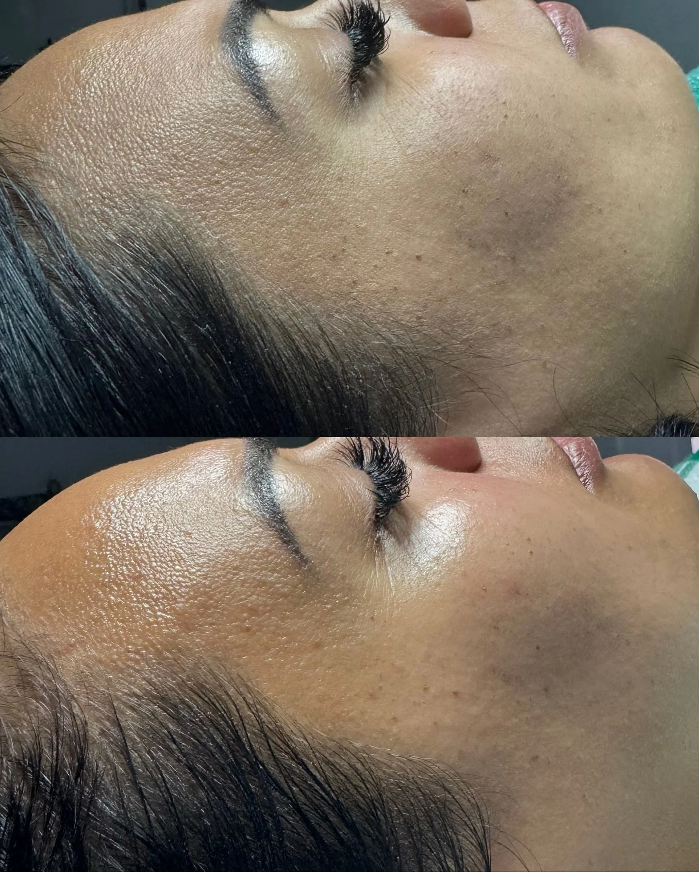 GLOW + GO&hellip;ONE HOUR DIFFERENCE 

Treatments can enhance your look, but skincare is what maintains it. Think of facials, injectables, and lasers as boosters, your daily routine is the foundation that keeps your skin healthy and radiant long-term