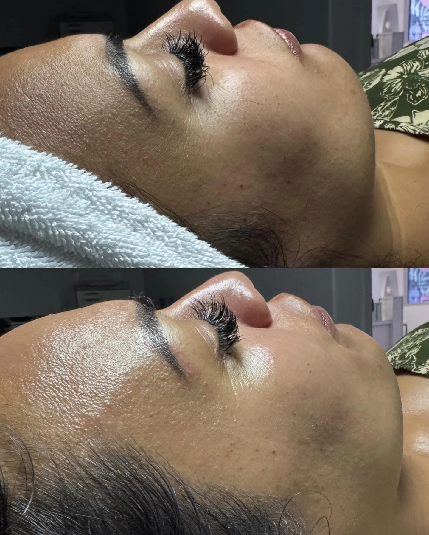 Are you making your skin a priority this year?

We are seeing so many clients that want to take steps toward happier and healthier skin.

An at-home regimen is so important, but make sure you see us regularly so we can address any concerns and set yo