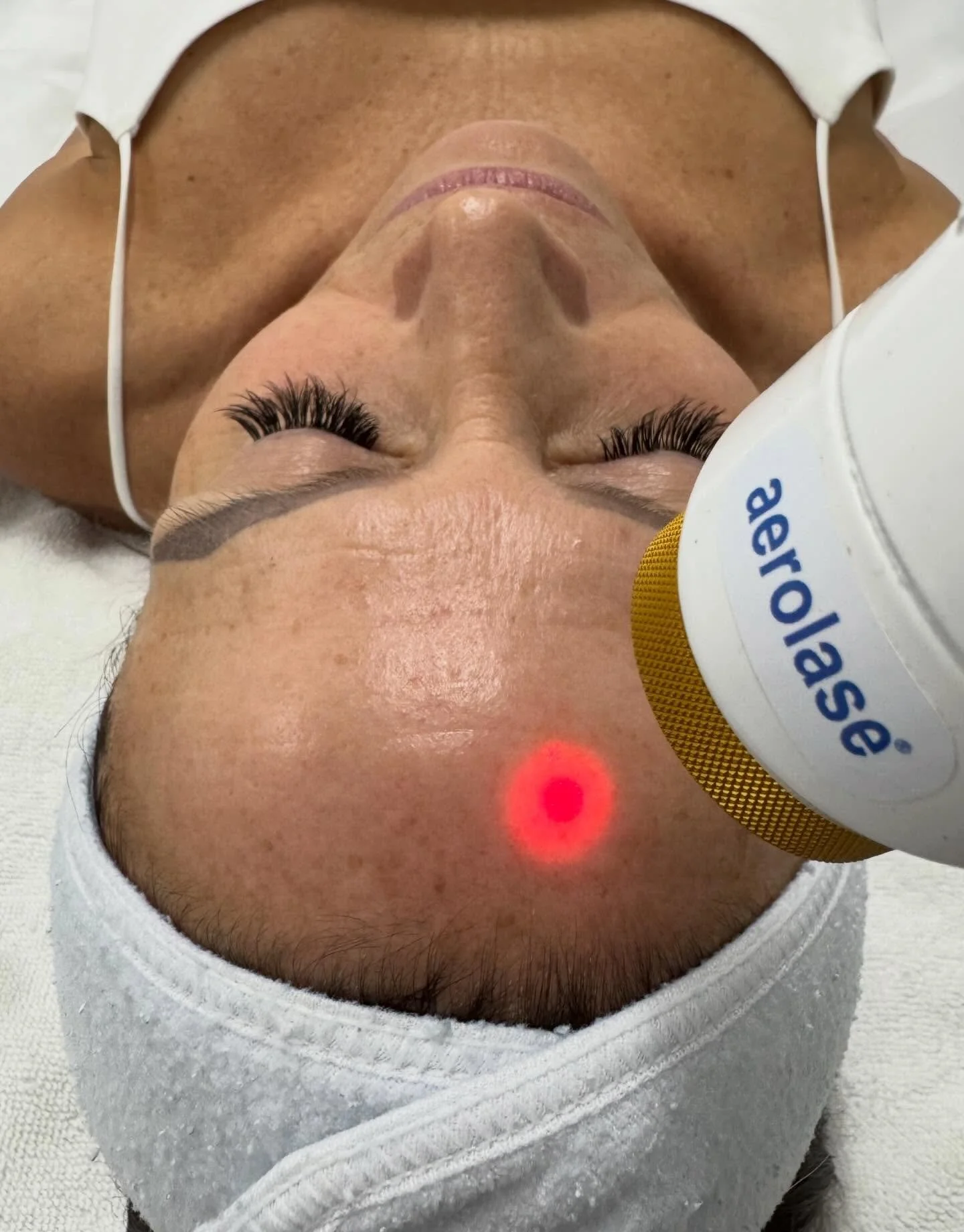 We&rsquo;re not just treating the surface we&rsquo;re rebuilding from within ✨

Aerolase stimulates collagen to smooth, firm, and rejuvenate the skin over time.

No downtime. Just results.

BOOK A CONSULTATION 
Book now: jadefacebody.com
Call/text: 8