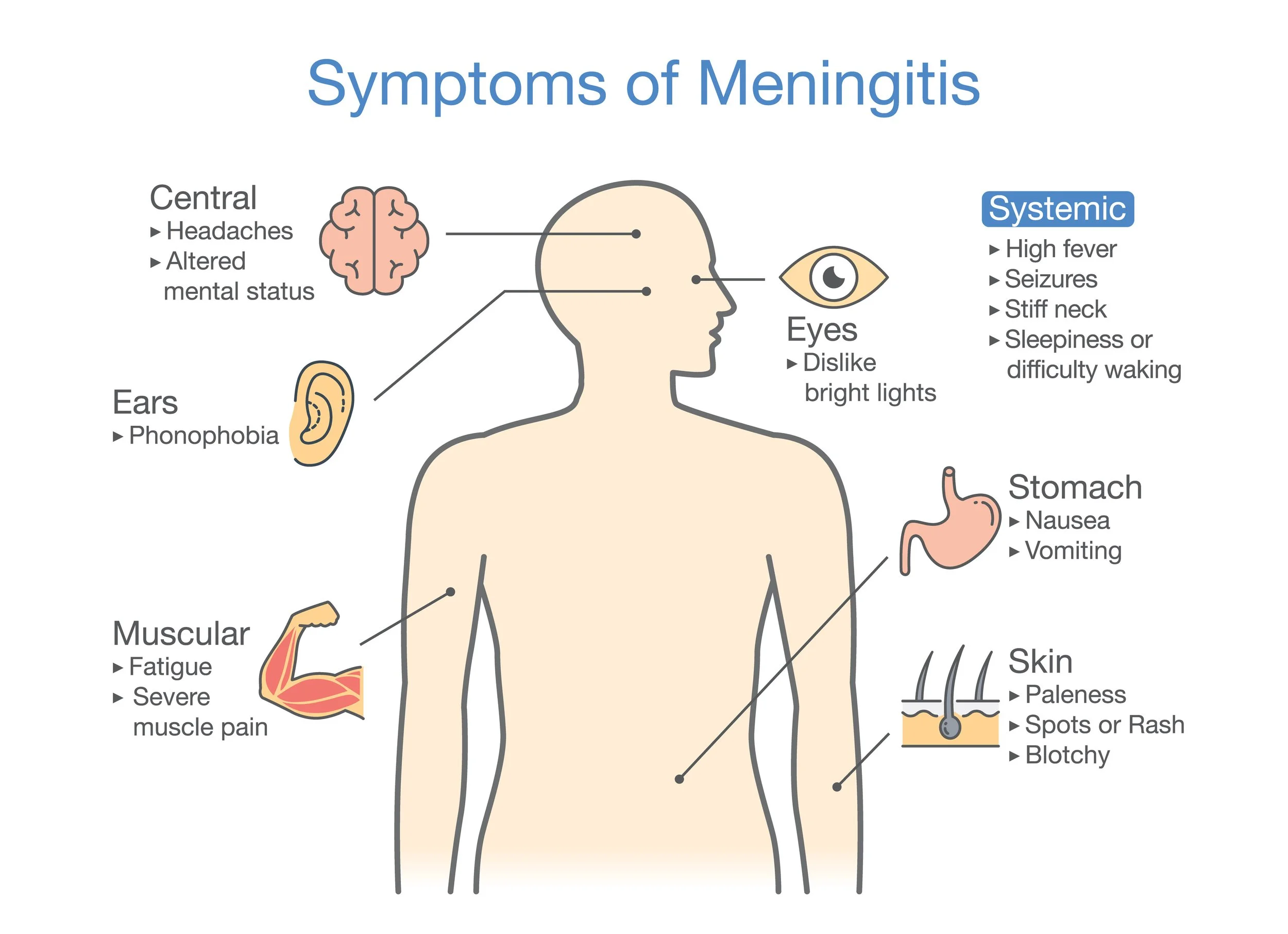 Could It Be Meningitis? The Symptoms to Look Out For