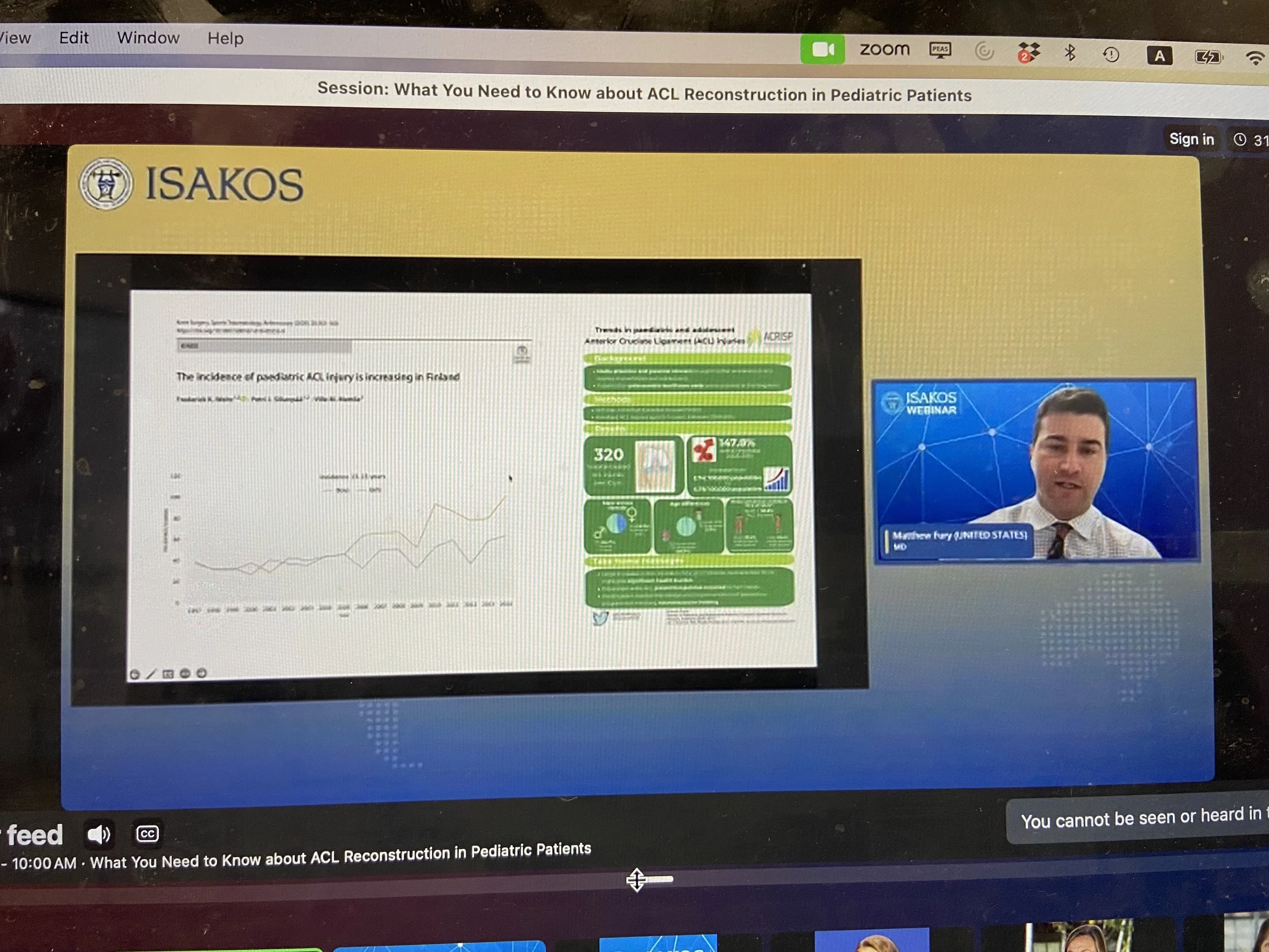 Dr. Fury presenting on pediatric ACL reconstruction on the ISAKOS Webinar