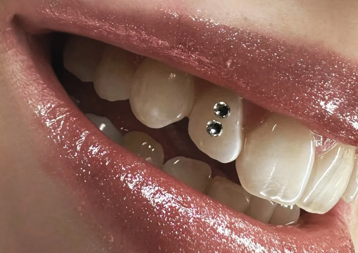 Close-up of a person smiling with white teeth and glossy lips.