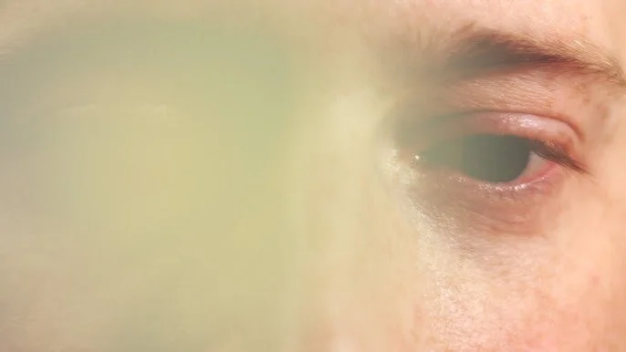 blindness 2.jpg