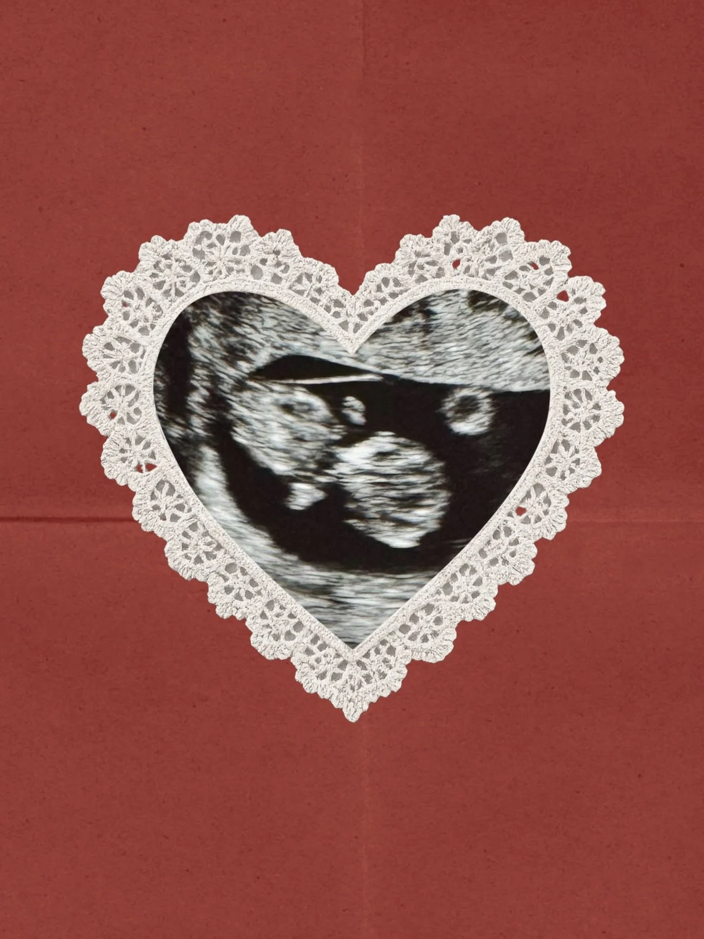 Our little Valentine ❤️

We&rsquo;re excited to share Baby Sirek will be arriving in August!