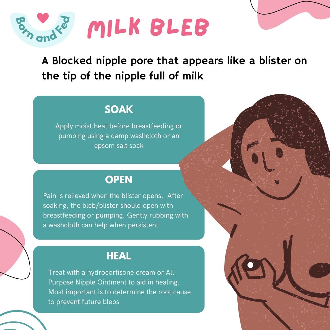 The dreaded milk bleb/milk blister (or as I like to call it, milk zit) is not something a nursing mother takes lightly. A milk bleb is simply a milk pore that has a piece of skin grown over creating a blister full of milk on the tip of the nipple. Mi