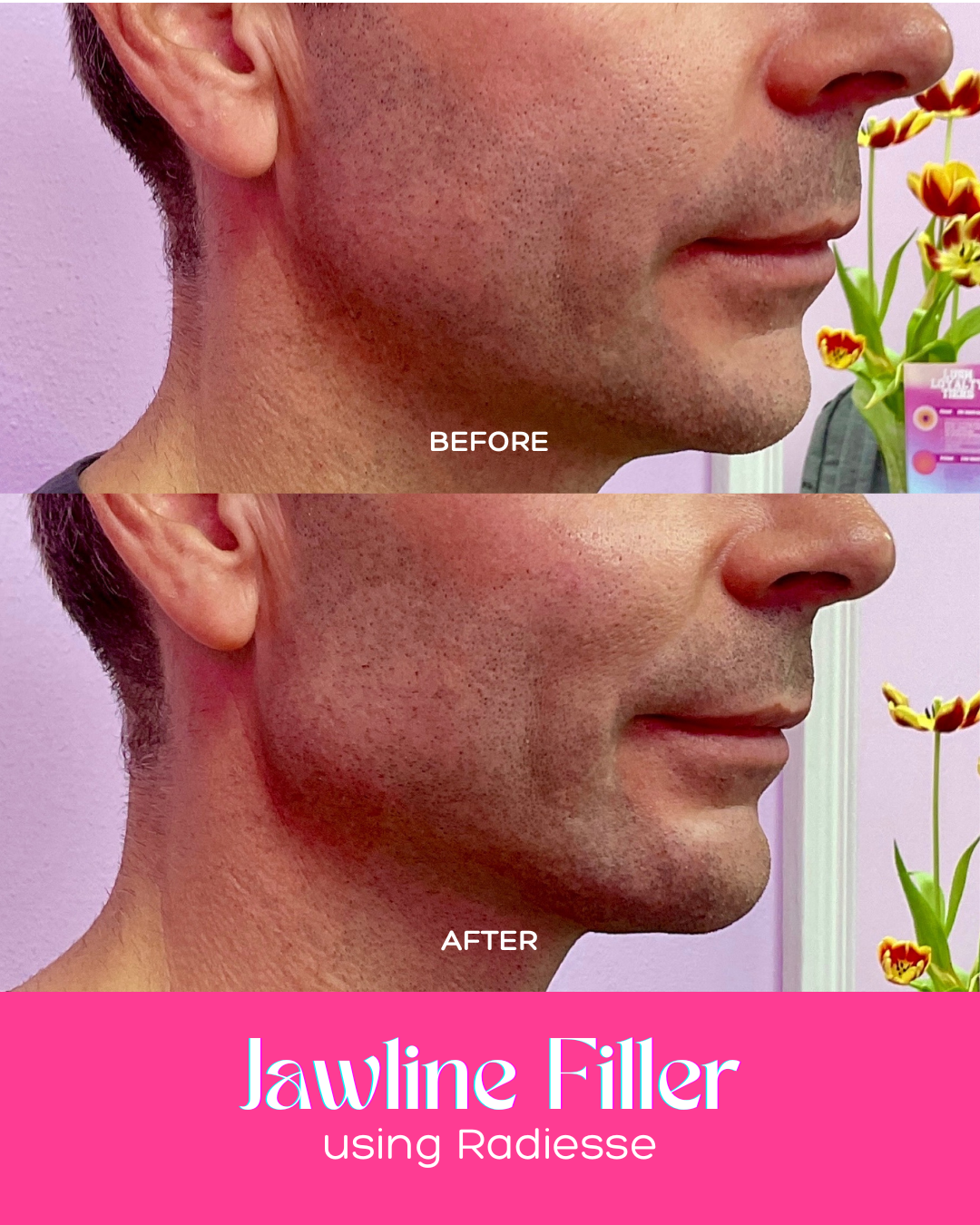 0512_JAWFILLERBA_C1.png