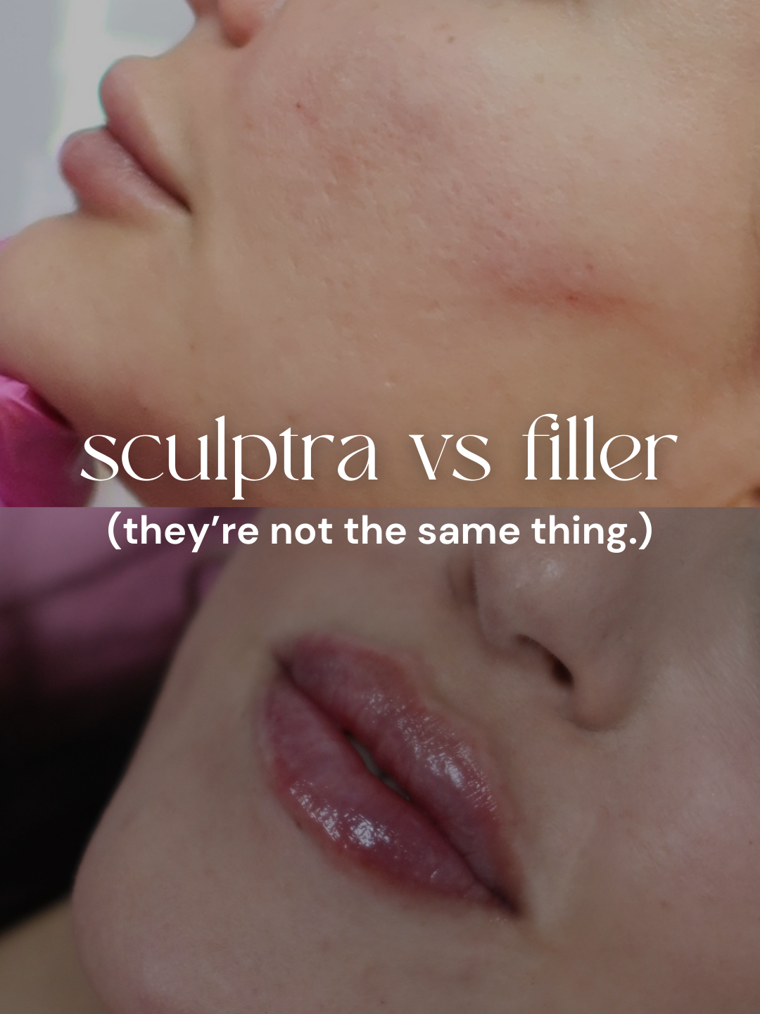 0309_SCULPTRA_C1.png
