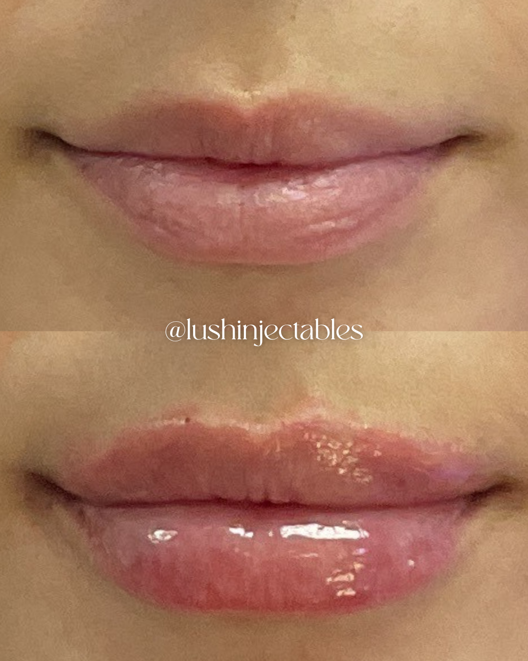 0209_LIPS_C2.png