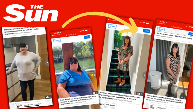 Sheila's weight loss story as featured in The Sun, with photographs before and after using hypnotherapy.