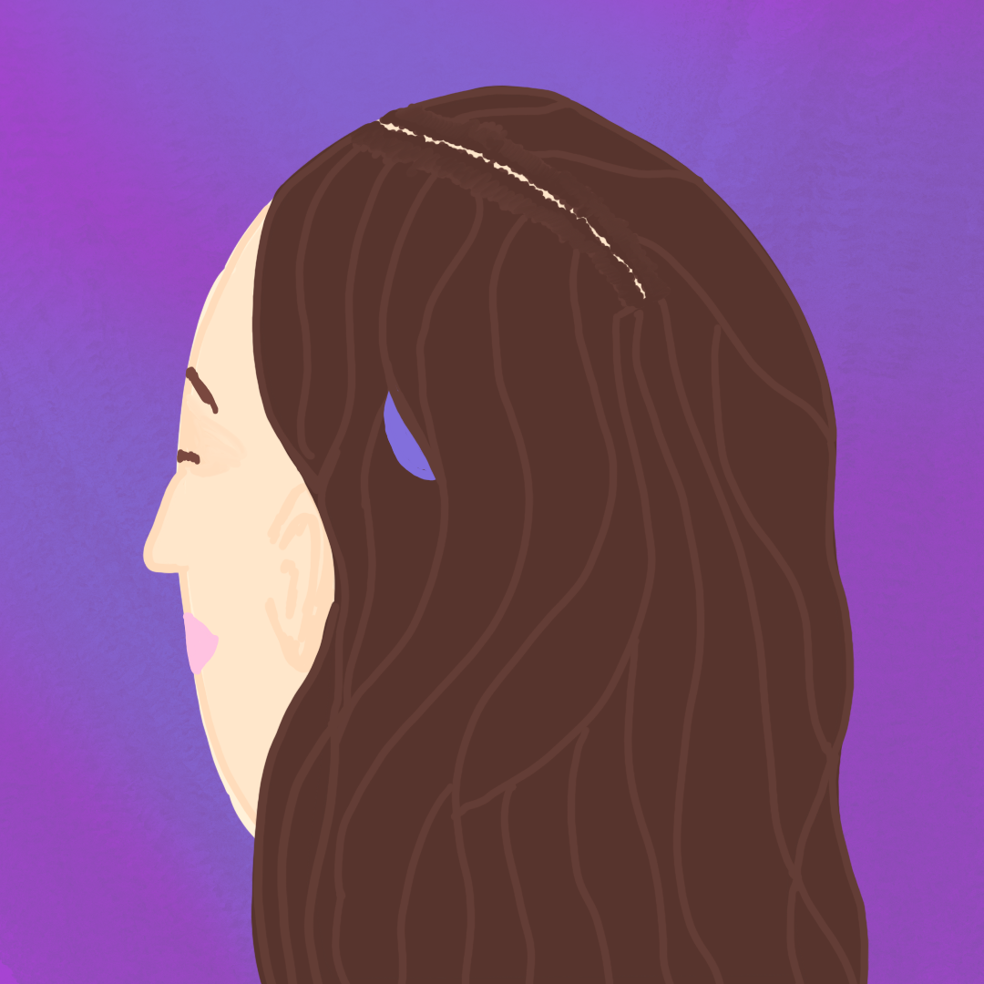  An art piece of a drawing of a woman with brown hair and a purple headpiece of a cochlear implant peeking out on a multi-purple background. This is to show what people see. 