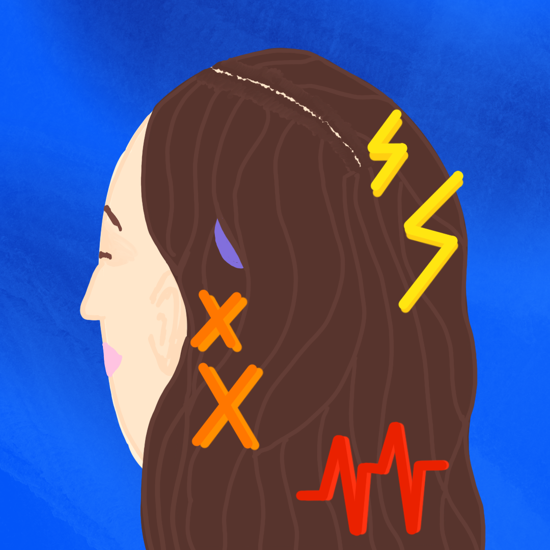  An art piece of a drawing of a woman with brown hair and a purple headpiece of a cochlear implant peeking out but with the addition of yellow lightning bolts, red heartbeat visual, and 2 orange “X” on a multi-blue background. The visual is to represent the pain that is not visible.  